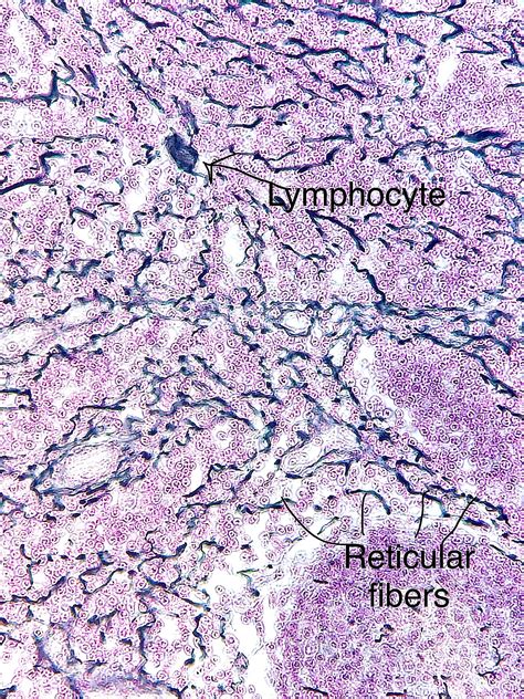 Reticular Connective Tissue