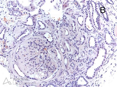 Congo Red Stain Tutorial | Teaching Points | Arkana Laboratories