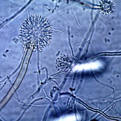 Sustainable Mycology: Aspergillus flavus