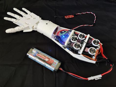 Designing a 3D-printed EMG bionic hand as a low-cost alternative to ...