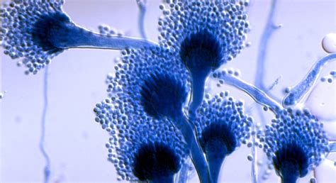 Aspergillus Microscope