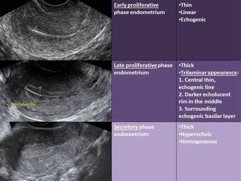 Pin by Vlada on Ultrasound/ Anatomy | Medical ultrasound, Ultrasound ...