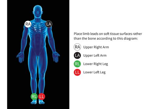 12 lead ECG Placement | ECG Leads Position| ADInstruments