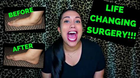 Flat Feet Reconstructive Surgery + Before and After - YouTube