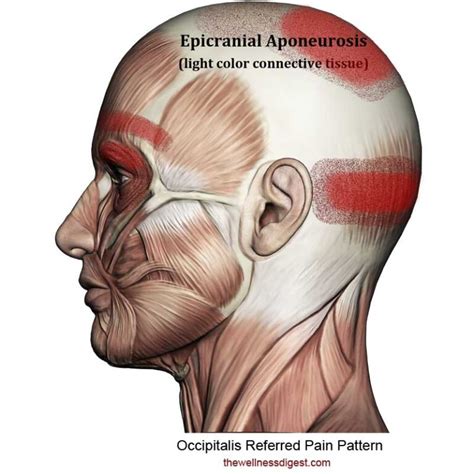 Occipitalis Muscle Pain - The Wellness Digest