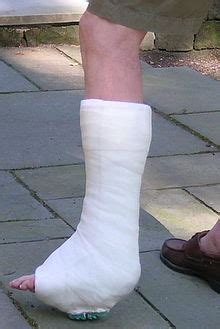 Orthopedic cast - Wikipedia