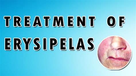 Erysipelas Symptoms, Treatment, and Causes - YouTube