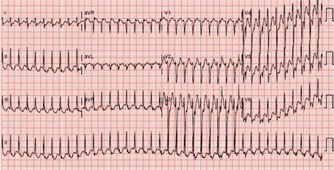 Southwest Journal of Pulmonary, Critical Care and Sleep - Imaging ...