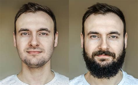 6 Reasons 'Why Can't I Grow a Beard' plus Growth Tips - Bald & Beards