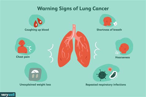 Lung Cancer Cough: Symptoms and Characteristics