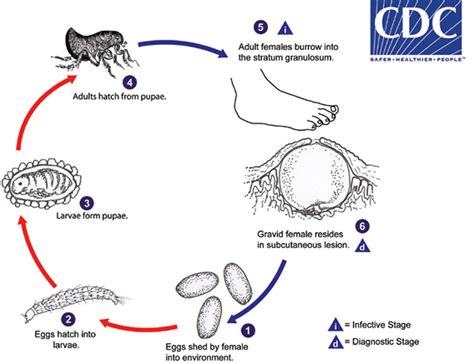 Tungiasis causes, symptoms, diagnosis, treatment & prognosis