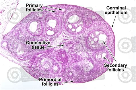 Rabbit. Ovary. Transverse section. 32X - Rabbit - Mammals ...