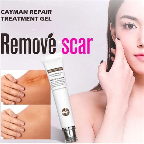 Cayman Acne Scar Removal Cream Skin Repair Face Cream Acne Spots Acne ...