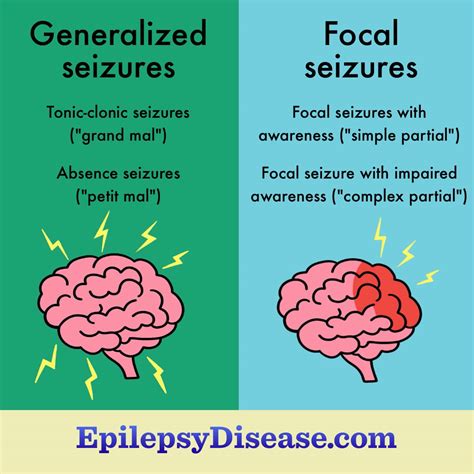 What Are The Types of Seizures With Epilepsy?