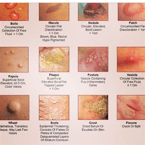 Medical Doctor on Instagram: "Different Skin Rashes #rash #skin #scale ...