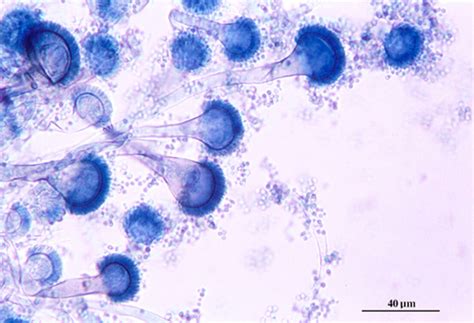 MBBS Medicine (Humanity First): Microscopic morphology of Aspergillus