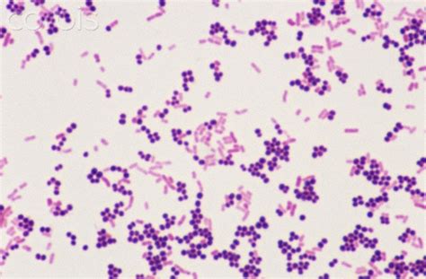 5 Steps of Gram Staining Procedure: How to Interpret the Results | New ...