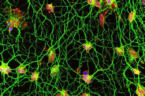 Human Skin Cells Transformed Into Motor Neurons - Neuroscience News