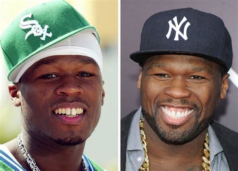 Top 15 celebrities with bad teeth in 2021 (with pictures) - Tuko.co.ke