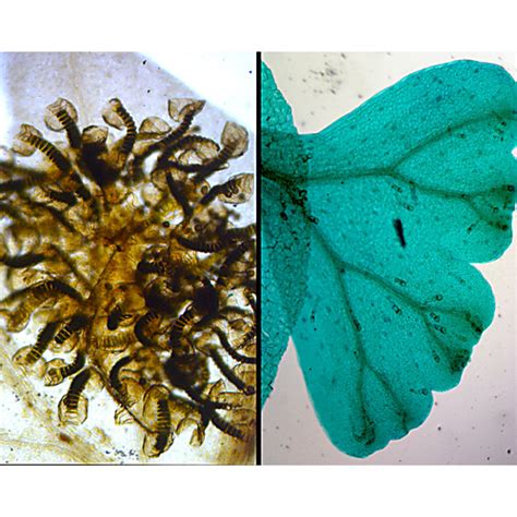 Prepared Microscope Slide,Fern, Prothallium, Sporophyte, Sporangia