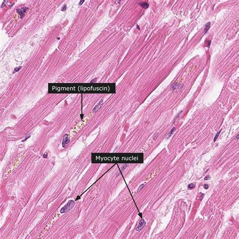 Dictionary - Normal: Heart muscle | Medical school studying, Medical ...