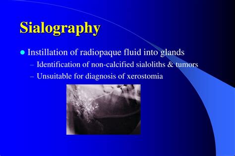 PPT - XEROSTOMIA PowerPoint Presentation - ID:757540