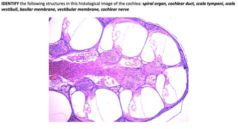 histology of the cochlea 1 Diagram | Quizlet