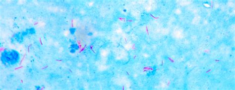 Acid Fast Stain Vs Gram Stain