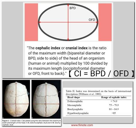 Brachycephaly Cephalic Index Chart: A Visual Reference of Charts ...