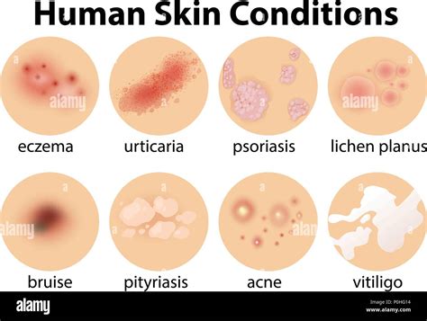 A Set of Human Skin Conditions illustration Stock Vector Image & Art ...