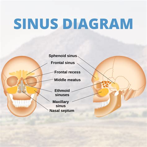 Sinus Diagram | Sinusitis, Sinus relief, Sinus congestion relief