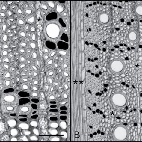 Xylem Parenchyma Diagram