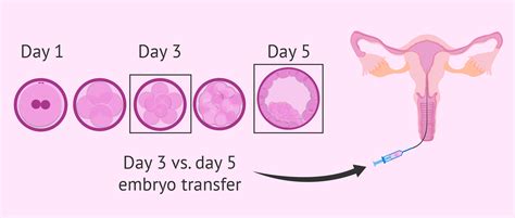 Day 5 embryo transfer due date - AyudhKristof