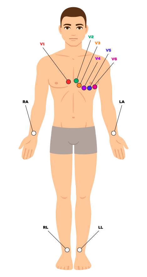 12-Lead ECG Placement Guide - CardiacDirect