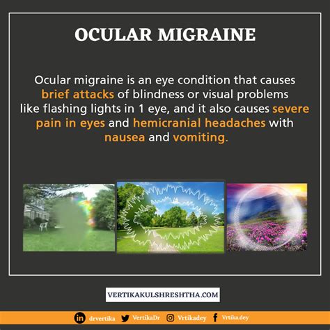 Flashing Lights In Eyes Ocular Migraine | Shelly Lighting