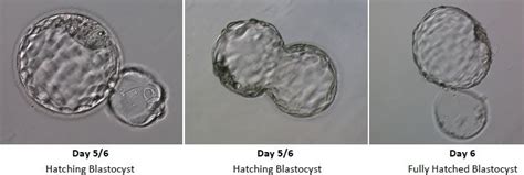 Embryo Development in IVF - Wilcox Fertility - Pasadena Fertility Doctor