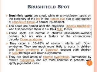 Dots spots lines and rings in ophthalmology | PPT