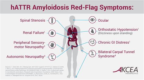 Do You Have Amyloidosis? Signs & Symptoms for AL, Wild Type and hATTR ...