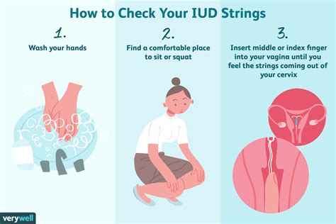 Iud String Color Chart