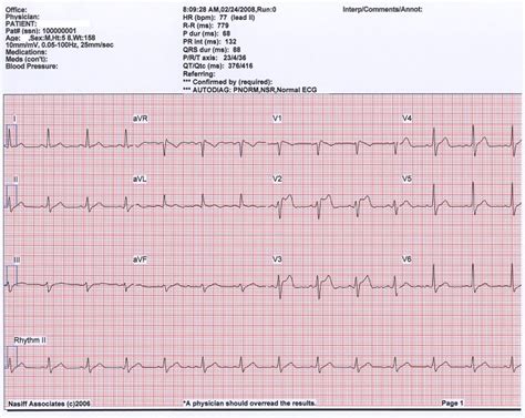 1-lead to 12-lead and exercise ECG