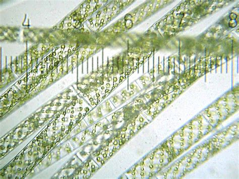 Spirogyra Microscope