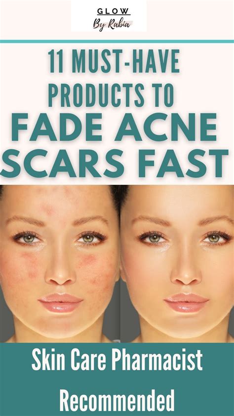 How to fade acne scars and hyperpigmentation fast – Artofit