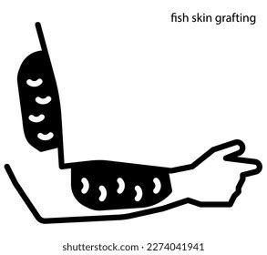 Fish Skin Grafting Wound Healing Stock Vector (Royalty Free) 2274041941 ...