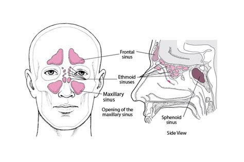 √ facial sinuses labeled 707167-Facial sinuses labeled