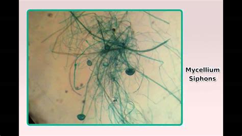 Different types of fungi under microscope - YouTube