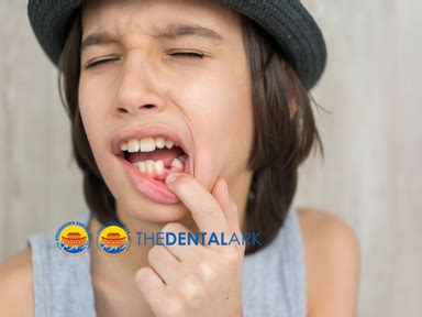 OOPS!! KNOCKED OUT YOUR TOOTH? HERE'S WHAT YOU SHOULD DO! | The Dental Ark