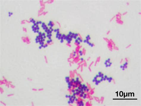 Gram staining - Simple English Wikipedia, the free encyclopedia