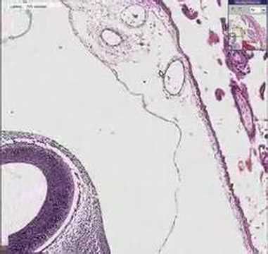 fallopian tube test