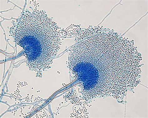 aspergillus under a microscope - Google Search | Things under a ...