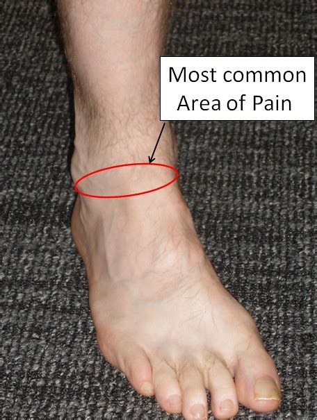 Foot Pain Under Ankle - The Complete Diagnosis and Treatment Guide!